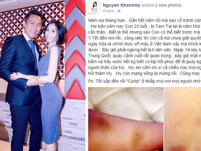 Khánh My bị dàn cảnh cướp, hành hung thương tích đầy mình