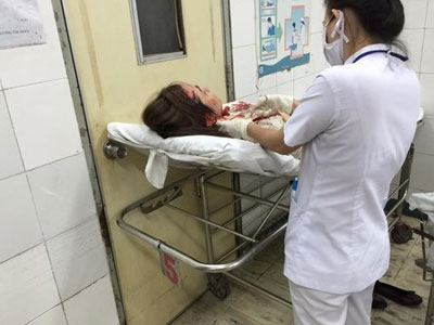 Bà xã mới cưới của Huỳnh Đông gặp tai nạn xe hơi