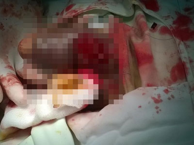 “Gãy súng” đêm giao thừa