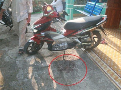 Dùng súng ru-lô tự chế bắn xuyên má bạn gái