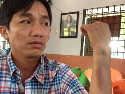 Con trai giám đốc công an tỉnh Cà Mau: "Tôi bị đánh hội đồng"