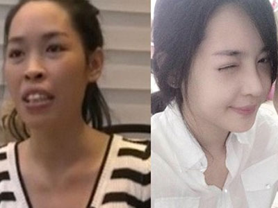 Tâm sự của cô gái Nam Định bỗng nổi tiếng vì thẩm mỹ