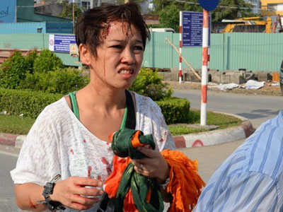 Bị rào chắn công trình đè trúng, người đi đường nhập viện