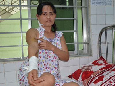 Pháo hoa rơi trúng đầu, 3 người nhập viện