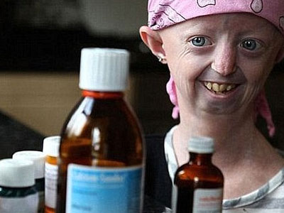 Cô gái 17 mắc kẹt trong cơ thể của bà lão trăm tuổi đã qua đời
