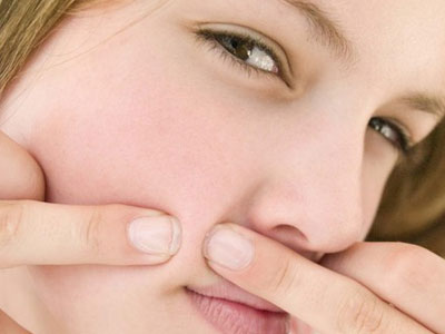 Có thật lấy chồng sẽ hết mụn?