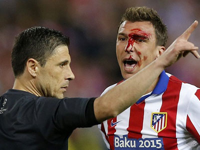 Mandzukic đổ máu vì Ramos, đo ván vì Carvajal