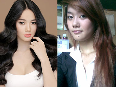 Rò rỉ hình ảnh Linh Chi thời mặt còn nốt ruồi, da đen nhẻm