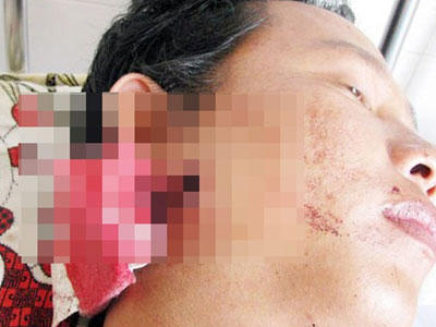 Kháng nghị vụ thanh niên trúng đạn từ súng trung tá công an
