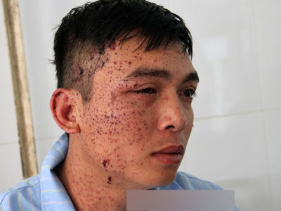 Lời kể kinh hoàng của con trai trong vụ bố ôm mìn tự sát