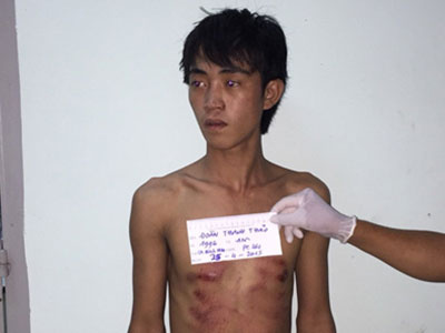 Say xỉn dùng kéo đâm chết bạn nhậu
