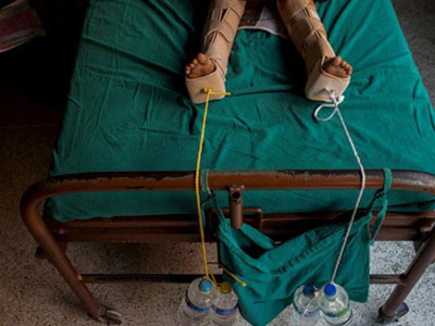 Hàng nghìn người sống sót động đất Nepal có thể tàn tật suốt đời