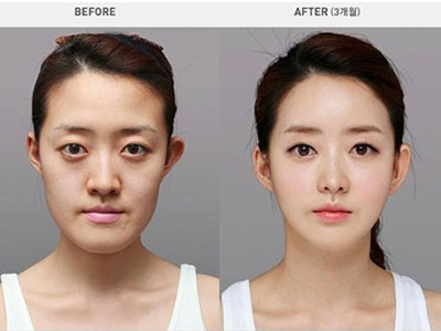 Chùm ảnh về PTTM khiến bạn phải thốt lên: Không có gì là không thể!