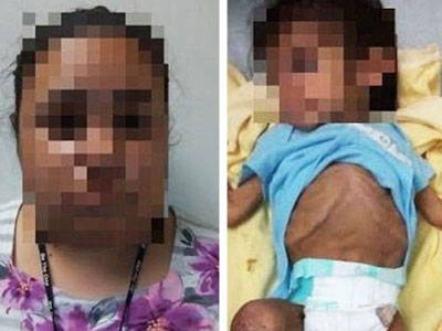 Chồng không đưa tiền, mẹ bỏ mặc con gần chết đói