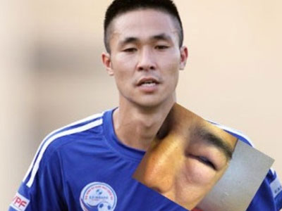 Scandal bóng phủi: Cầu thủ V-League bị tố đánh người