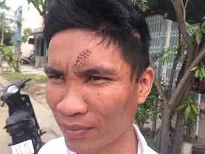 Ảnh bìa bài viết 297346