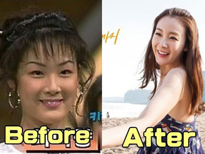 Lộ ảnh Choi Ji Woo chưa phẫu thuật thẩm mỹ năm 19 tuổi