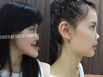 Ca PTTM thành công của cô gái có gương mặt lệch đến khó tin