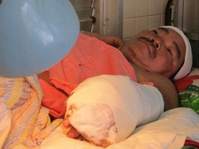 Ngăn hàng xóm chửi nhau, bị chặt rớt tay