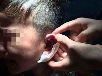 Cô giáo mầm non dùng dập ghim dập tai học sinh giờ nghỉ trưa