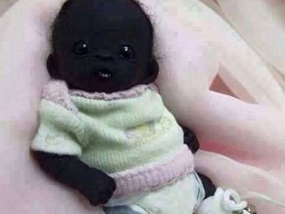 Sự thật ngỡ ngàng về "Em bé châu Phi đen nhất thế giới"