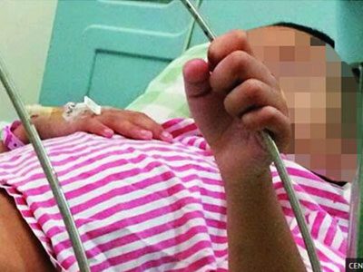 Trung Quốc: Nhập viện vì bị bạn học cắn "của quý"