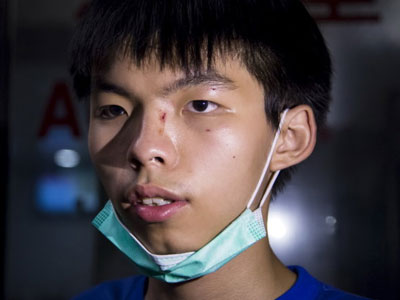 Joshua Wong bị đánh sau khi đi xem phim cùng bạn gái