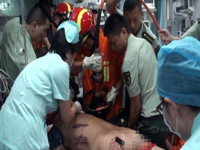 Hãi hùng tai nạn người đàn ông bị thanh sắt 2m xuyên thủng người