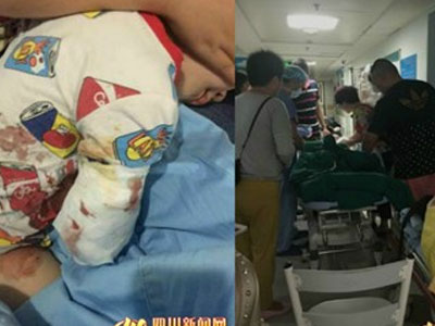 Thăm vườn bách thảo, bé 2 tuổi bị hổ cắn đứt cánh tay