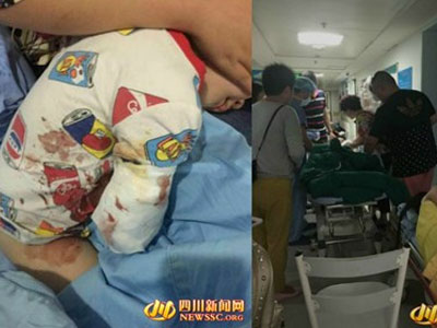 Thò tay vào chuồng hổ, bé 2 tuổi bị cắn đứt cánh tay
