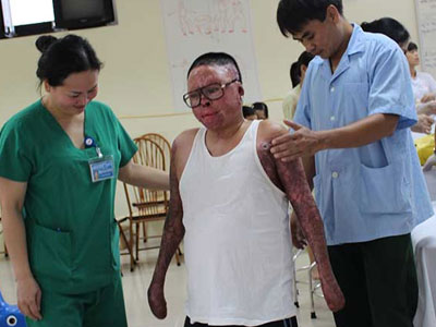Nghị lực phi thường của người lính sống sót sau vụ máy bay rơi