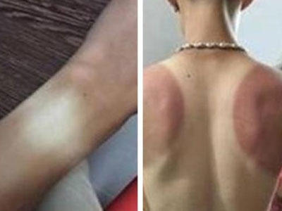 Hãy mua ngay áo chống nắng cho chồng!