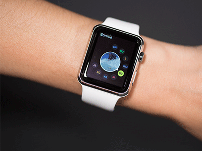 Apple Watch bị phàn nàn gây bỏng tay