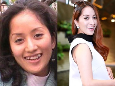 Mỹ nhân Việt và những khoảnh khắc "răng lợi" không muốn nhìn lại