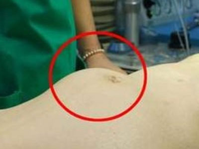 Căn bệnh nguy hiểm có tên "cái chết không hẹn trước" bạn cần biết