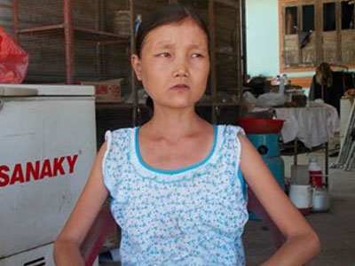 Bác sĩ nói gì về cô gái ngày ăn 6 lon gạo, uống 15 lít nước
