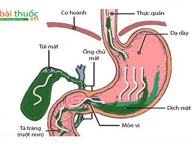 "Thủ phạm" giấu mặt gây bệnh ung thư mà bạn không ngờ đến