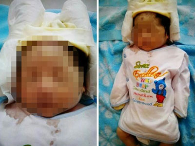 Sản phụ có con "ruột trào khỏi bụng" tố bệnh viện khiến trẻ chết oan