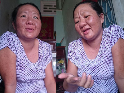 Dùng thuốc dị ứng, bà bầu "biến thành" bà lão U60