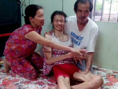Đau đớn nữ sinh 18 tuổi liệt toàn thân chỉ sau một tháng phát bệnh hiếm gặp