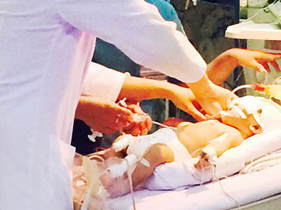 Bé sơ sinh bị đâm dao xuyên đầu vẫn đang nguy hiểm