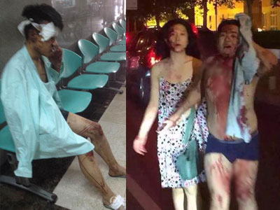 Chùm ảnh: Người dân bàng hoàng, nằm la liệt trong bệnh viện sau vụ nổ kinh hoàng