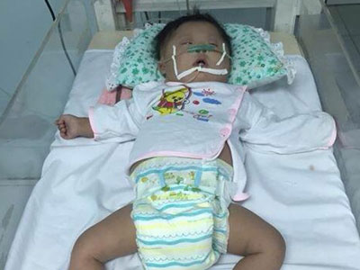 Bé gái sơ sinh mắc bệnh Down bị mẹ bỏ lại bệnh viện