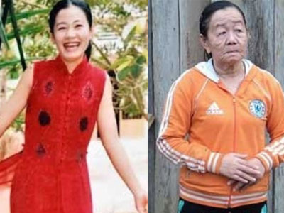 Cô gái xinh đẹp hóa bà lão đột ngột qua đời