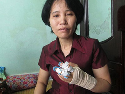 Một phụ nữ bị hàng xóm chém lìa hai ngón tay