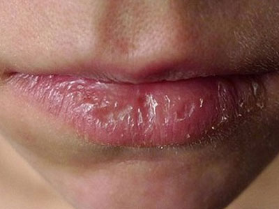 Nguy cơ hỏng môi, ngộ độc chì từ son môi kém chất lượng