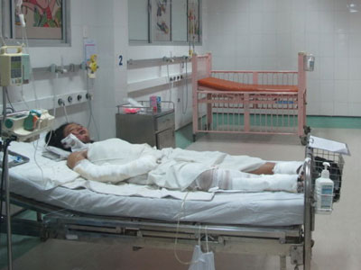 Bé gái bán vé số bị mẹ đốt đang nhiễm trùng huyết