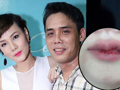 Chồng Dương Yến Ngọc phủ nhận đánh vợ