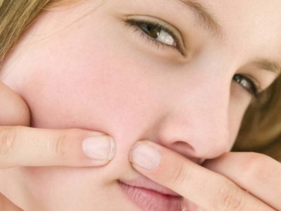 Không nên nặn mụn ở những vùng “tử thần” nào?