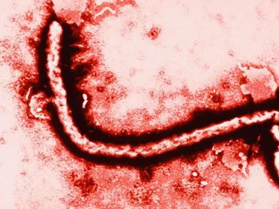 Nguy cơ tái bùng phát dịch Ebola vì… “tự sướng”